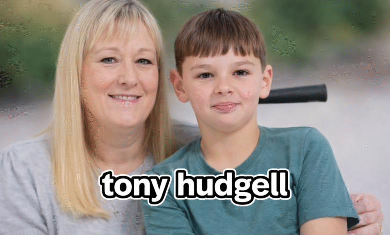 Tony Hudgell