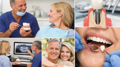 Dental Implants Newcastle